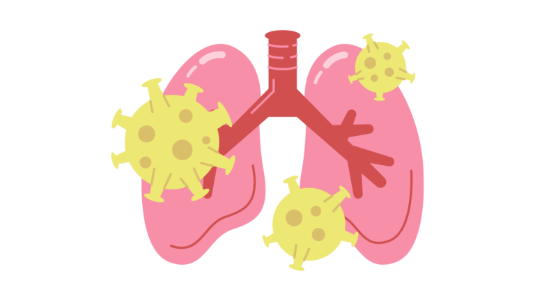 Community Acquired Pneumonia